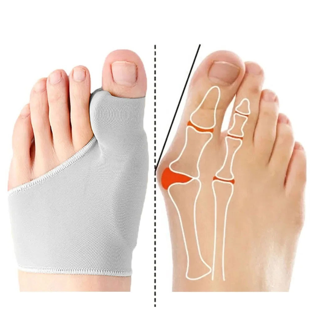 Ankle Brace Sock - Séparateur d'orteils, correcteur d'oignon Hallux Valgus,