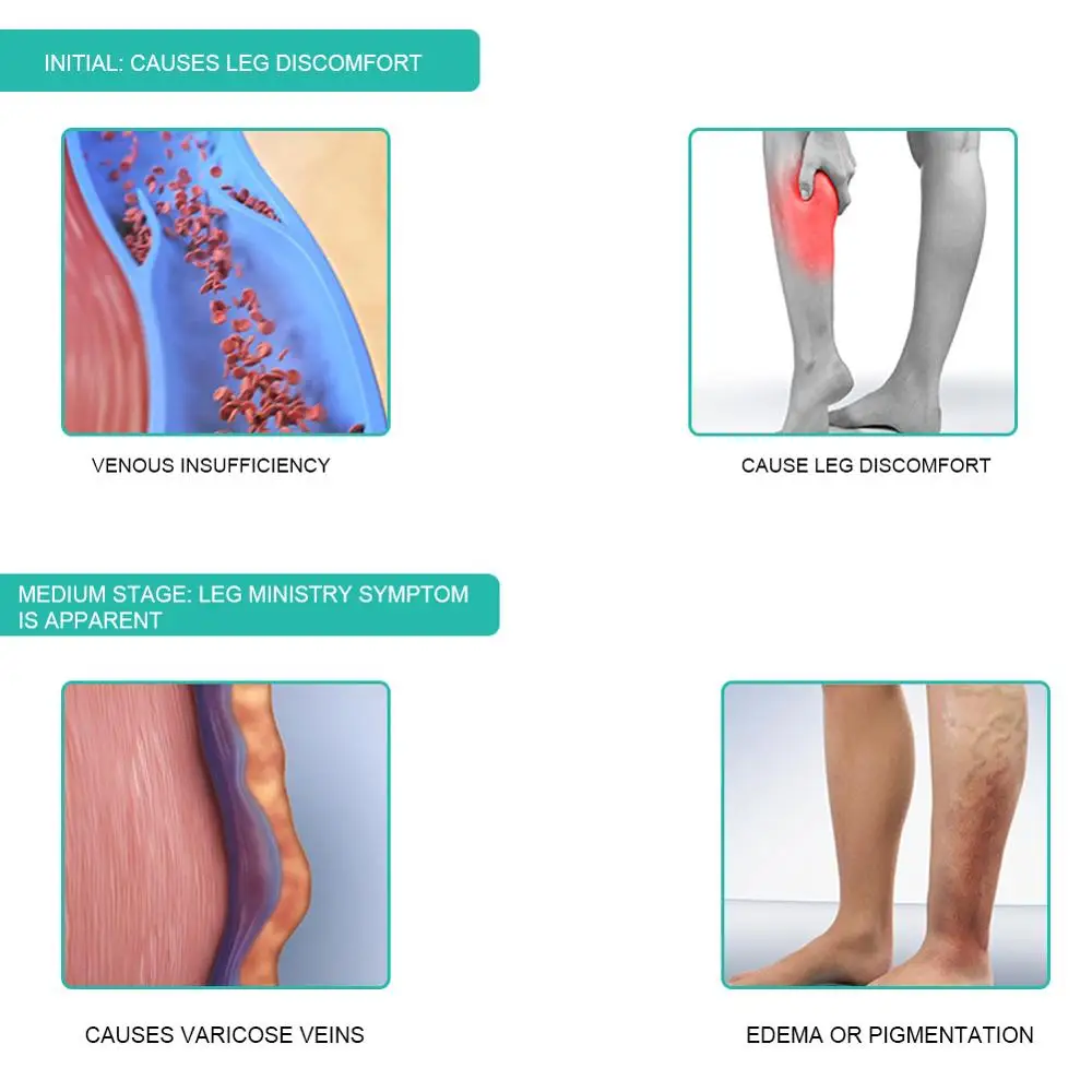 1 paire de chaussettes de Comp - Compression Sleeve Calf avis et prix